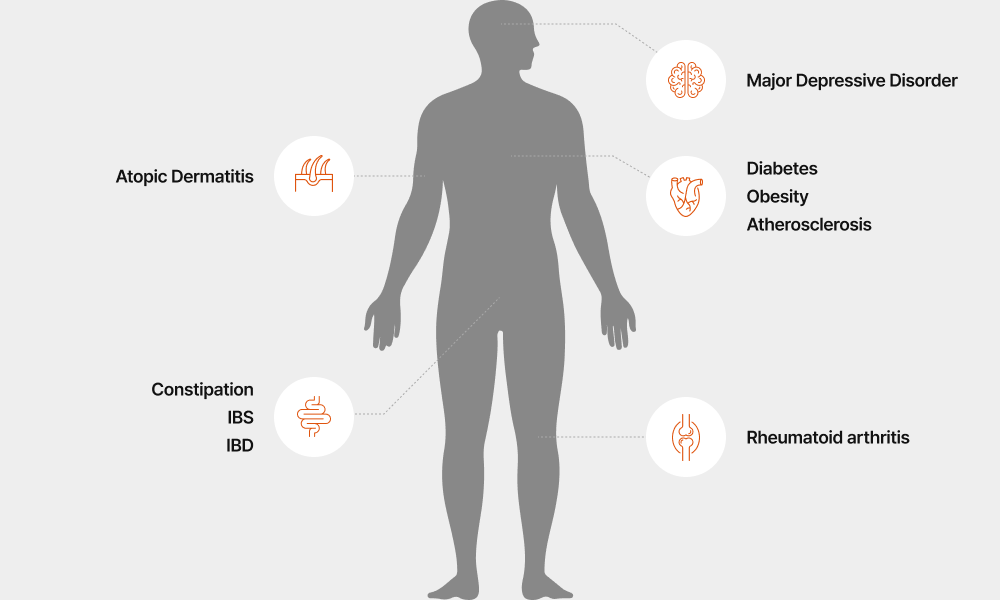 Major Diseases Related to Gut Microbiome